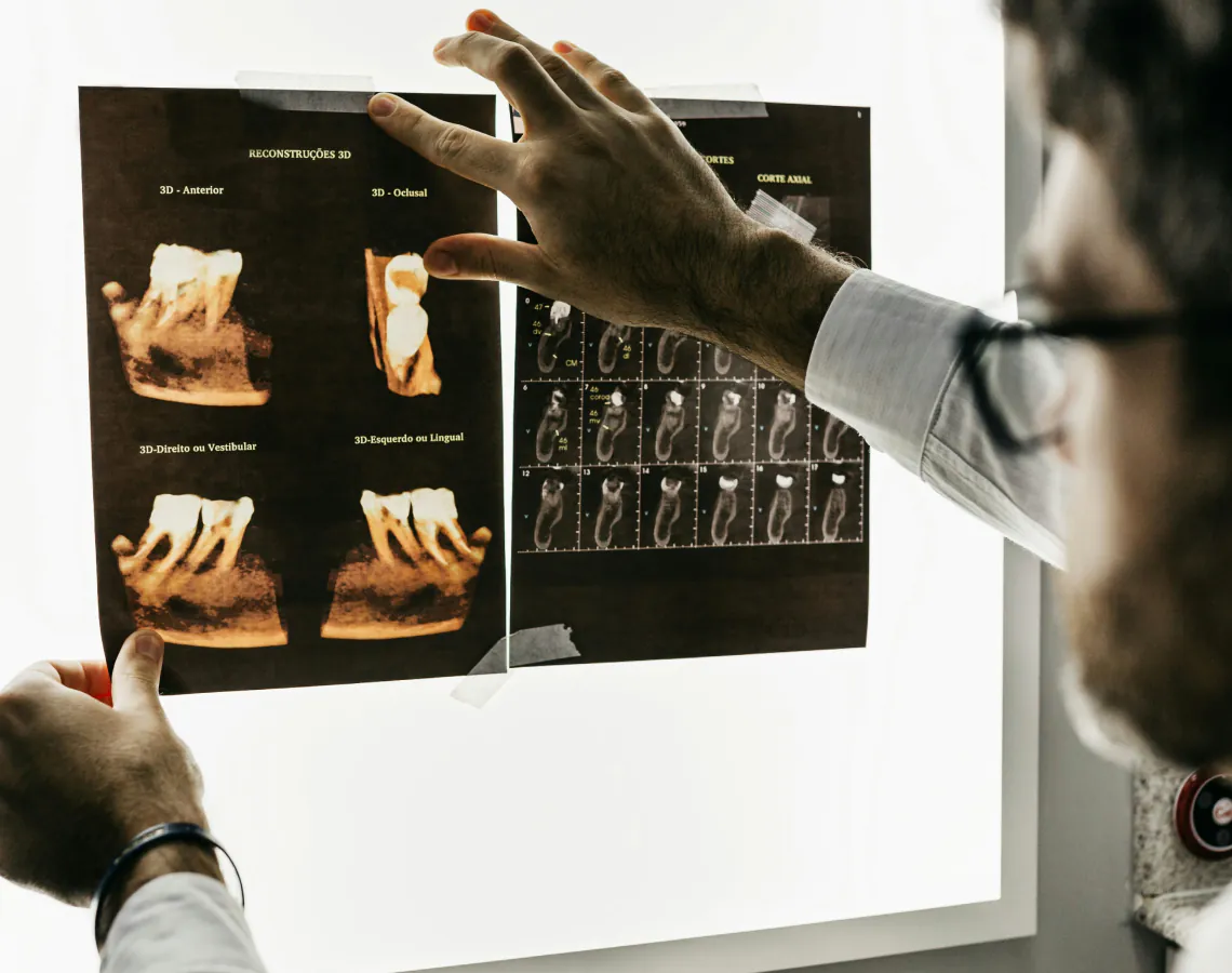 Dental Costs in Mexico vs USA: How Much Can You Really Save?